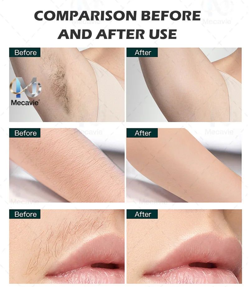 Professional 4-Wave 808nm Diode Laser Hair Removal Machine 4000W Soprano Titanium Painless Hair Remover for Face Body Home Salon