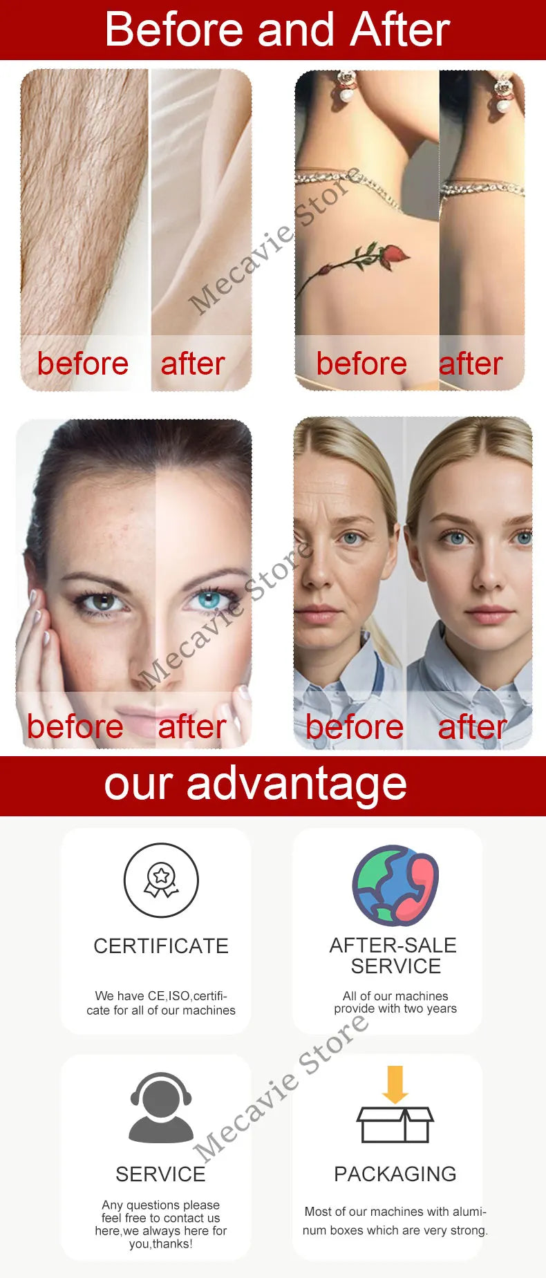 4000W 4-in-1 Diode Hair Removal And Tattoo Removal Photon Skin Rejuvenation And Firming Beauty Salon Exclusive 4 Wavelengths